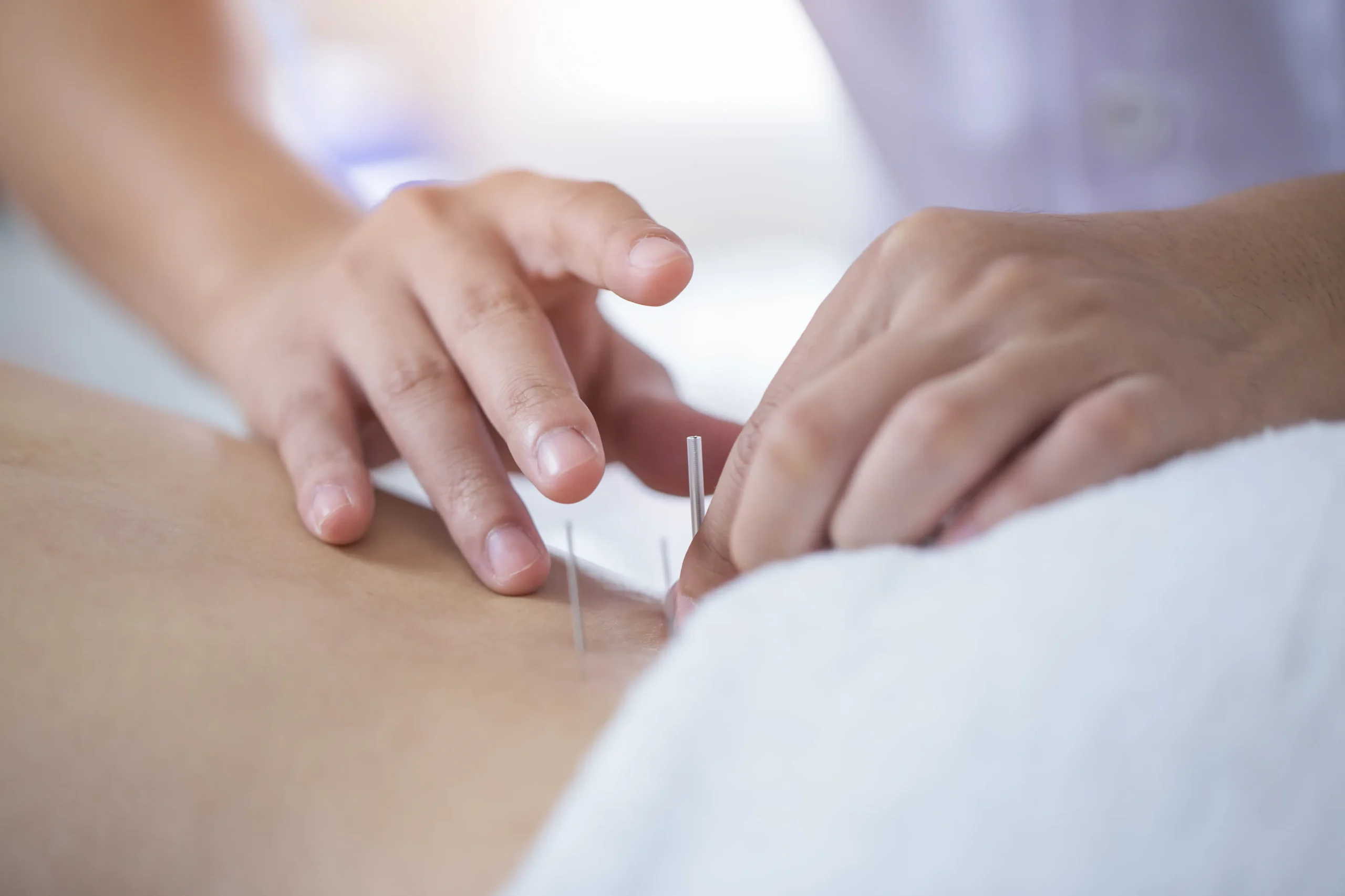 自宅で受けられる鍼灸ケアとは？訪問鍼灸のメリットと活用法を解説
